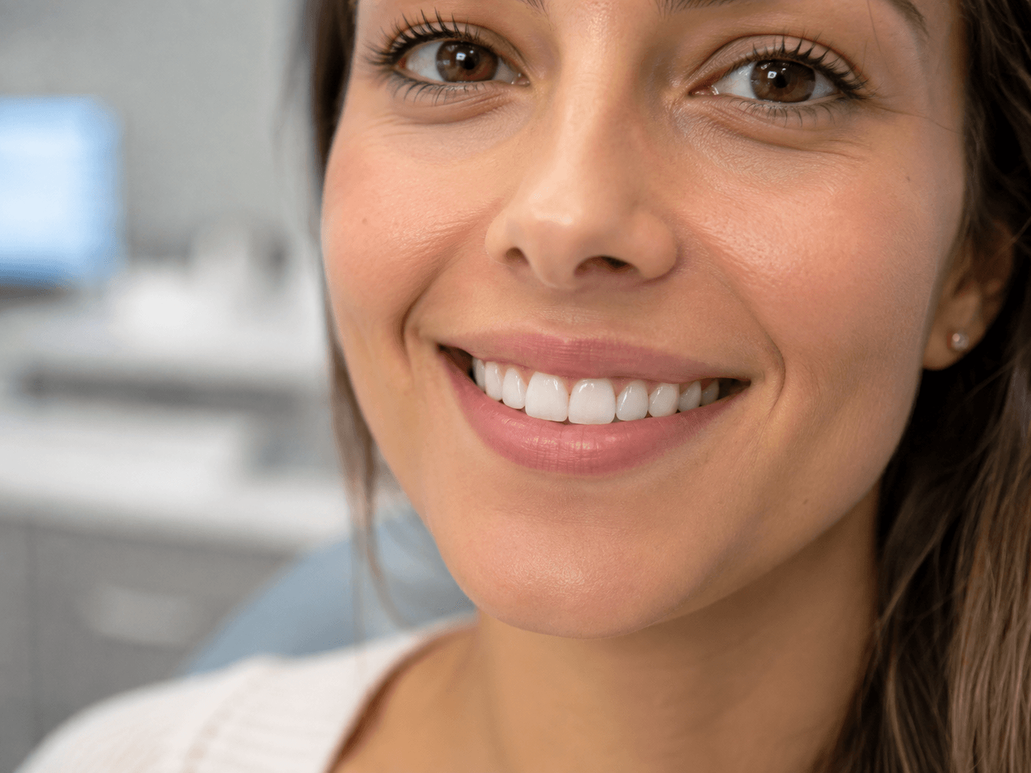 Primer plano de una sonrisa con los dientes de adelante restaurados
